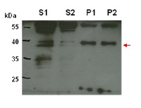 CPT6 | cis-prenyltransferase 6 in the group Antibodies Plant/Algal / Environmental Stress / Cold stress at Agrisera AB (Antibodies for research) (AS14 2768)